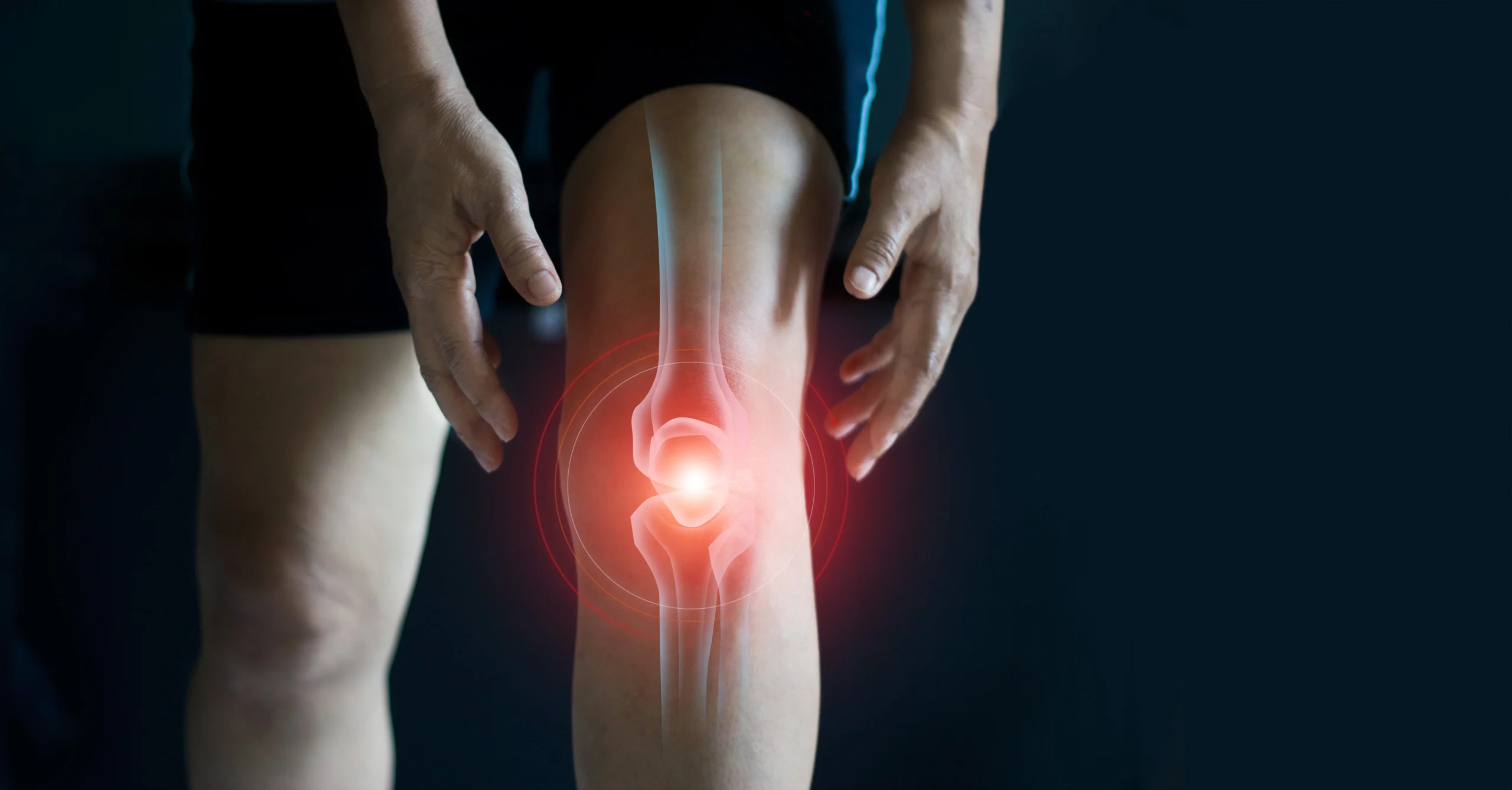 Understanding and Managing Knee Arthritis Treatment